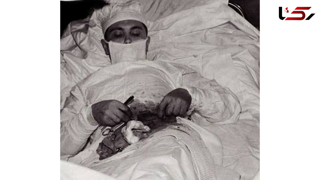 پزشکی که آپاندیس خود را جراحی کرد+عکس