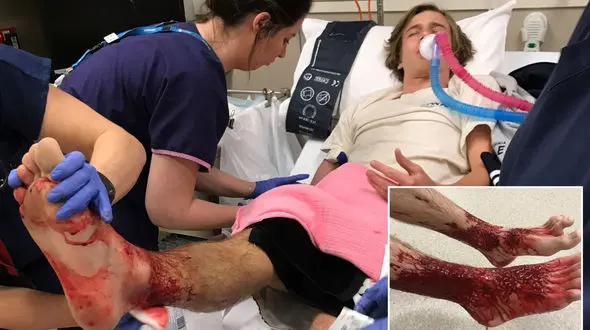 کار وحشتناک شپش‌های دریایی خونخوار بر روی ماهی ها و انسان + فیلم 