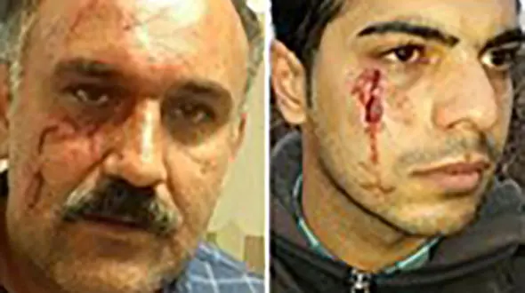 حمله وحشیانه شکارچیان به 2 محیط بان در مازندران + عکس