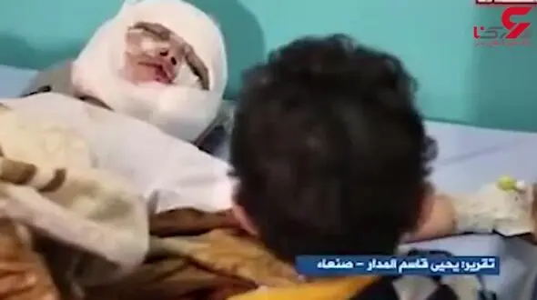 درددل تکاندهنده کودک یمنی با برادر زخمی اش + فیلم