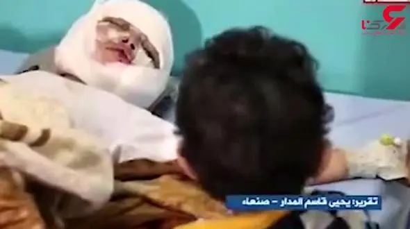 درددل تکاندهنده کودک یمنی با برادر زخمی اش + فیلم
