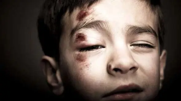 آمار کودک آزاری در ایران 5 برابر شده است / نسبت به قبل از دوره کرونایی