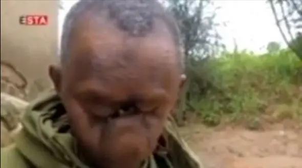 فیلم  / این زن اصلا صورت ندارد ! / نحوه نفس کشیدن و غذا خوردنش را ببینید