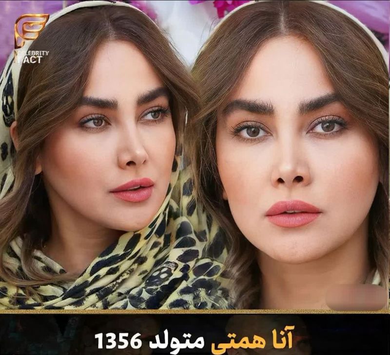 آنا نعمتی