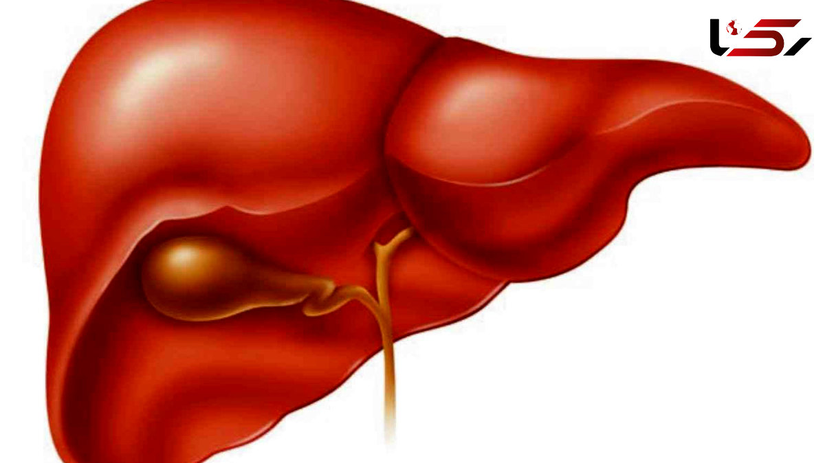 تصفیه خانه بدن را پاکسازی کنید/ اگر کبد چرب دارید این مطلب را بخوانید+فیلم