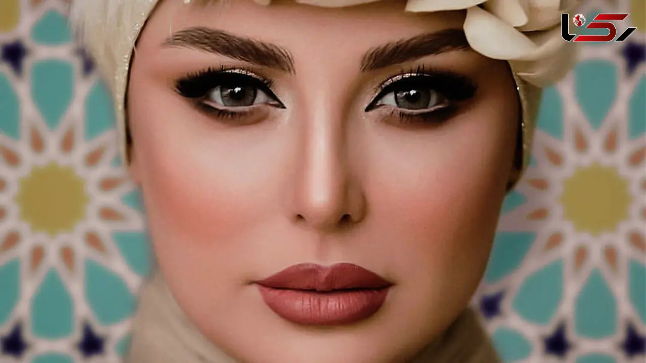 عکس از دماغ عملی جدید نیوشا ضیغمی از نمای نزدیک  !