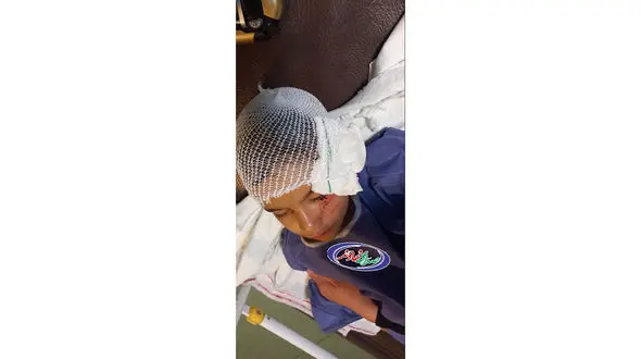 عکس لت و پار شدن پسر بچه ای توسط سگ ولگرد / در همدان رخ داد