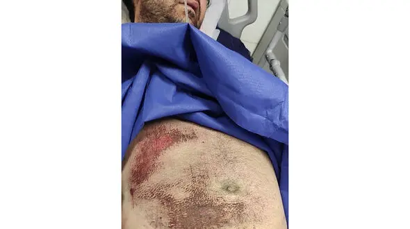 جزئیات زورگیری وحشیانه از یک عکاس خبری در تهران + عکس