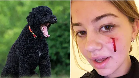 حمله خونین سگ اوباما در کاخ سفیدبه دختر جوان+عکس 