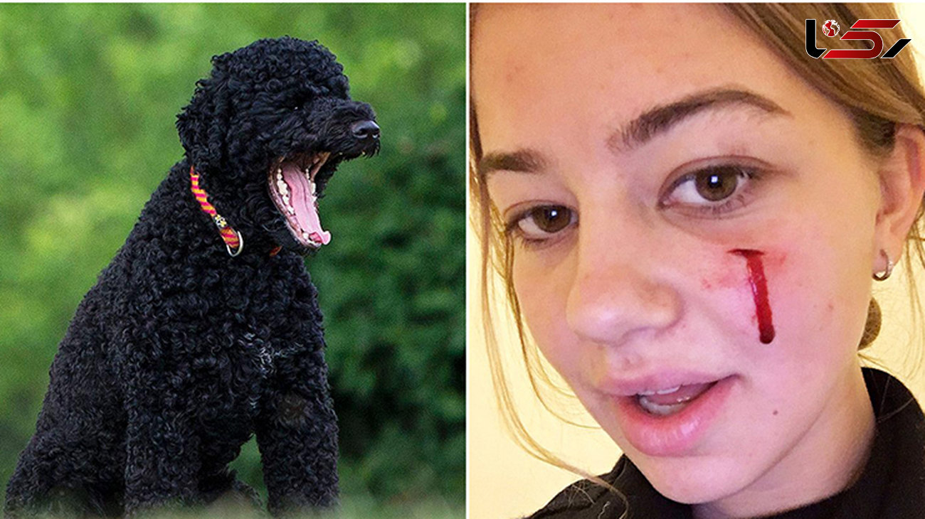 حمله خونین سگ اوباما در کاخ سفیدبه دختر جوان+عکس 