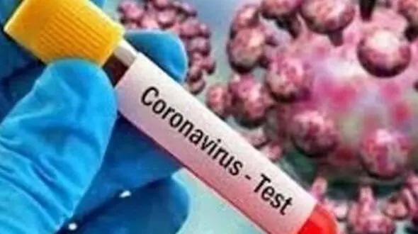 مهتاب ایمانی از دردهای کرونایی اش گفت! / 24 ساله ام!
