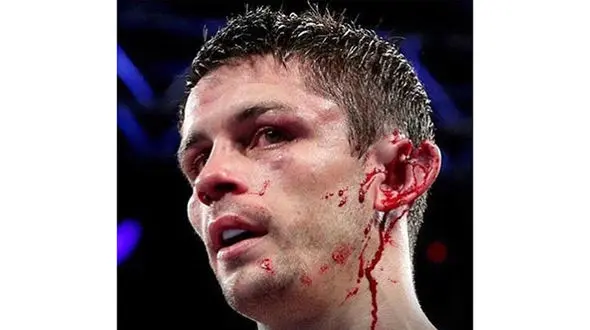 گوش این مرد ورزشکار چطور کنده شد! +عکس های تکاندهنده 