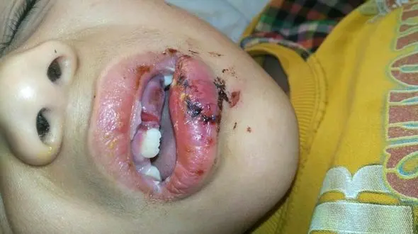 این دانش آموز در مدرسه اش سرنوشت هولناکی داشت! + عکس