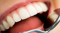 6 روش خانگی برای سفیدکردن دندان ها