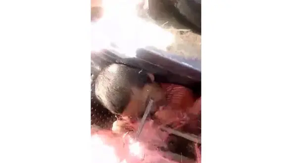 فیلم صحنه دلخراش گیر کردن کودک در خرمن کوب / نجات این کودک بجنوردی معجزه آسا بود+عکس