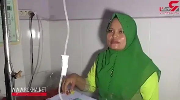 تولد نوزاد تک چشم در اندونزی! +فیلم 16+