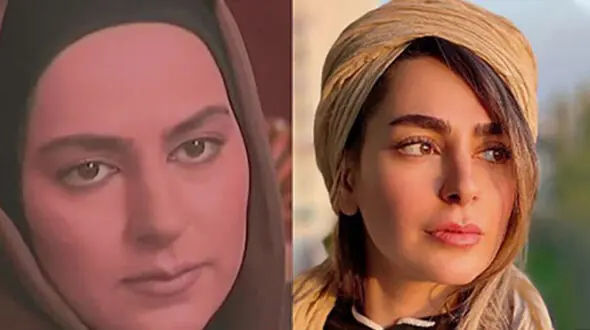 لیست جراحی‌های سمانه پاکدل لو رفت /  چه بوده و چه شده! + عکس ها