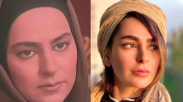 لیست جراحی‌های سمانه پاکدل لو رفت /  چه بوده و چه شده! + عکس ها