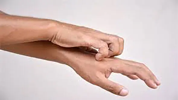 زنگ خطر کرونا از روی 3 نشانه پوستی