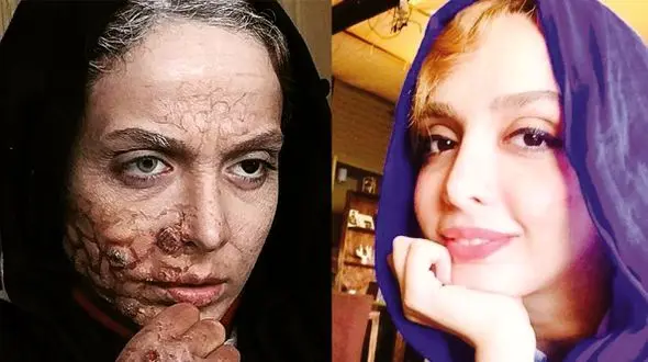 عکس ها / بازیگرانی که با بیماری جذامی در سینما بازی کردند / از المیرا دهقانی تا اندیشه فولادوند و ....