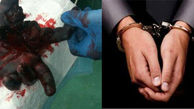 عکس دست قطع شده امید 14 ساله از ترس مردهمسایه! + جزییات دادگاه