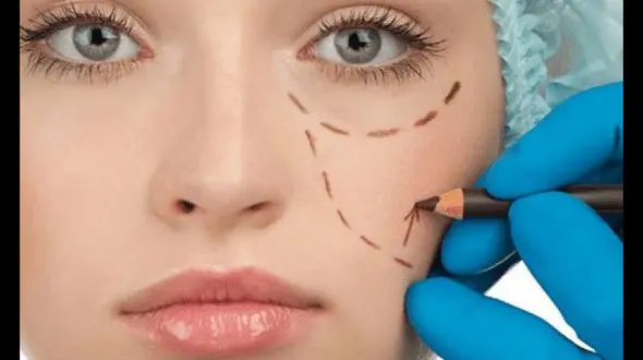 دردسرهای علمی بینی های عروسکی و پروتز از زبان متخصصان