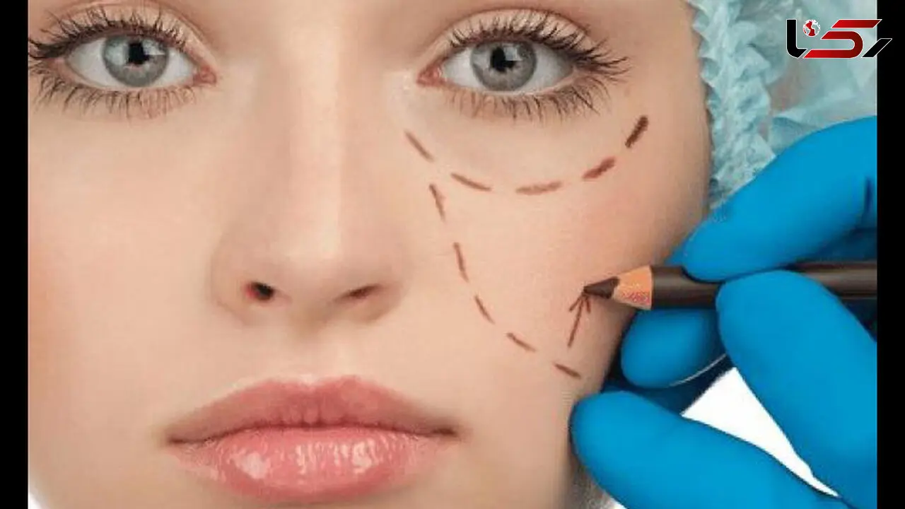 دردسرهای علمی بینی های عروسکی و پروتز از زبان متخصصان