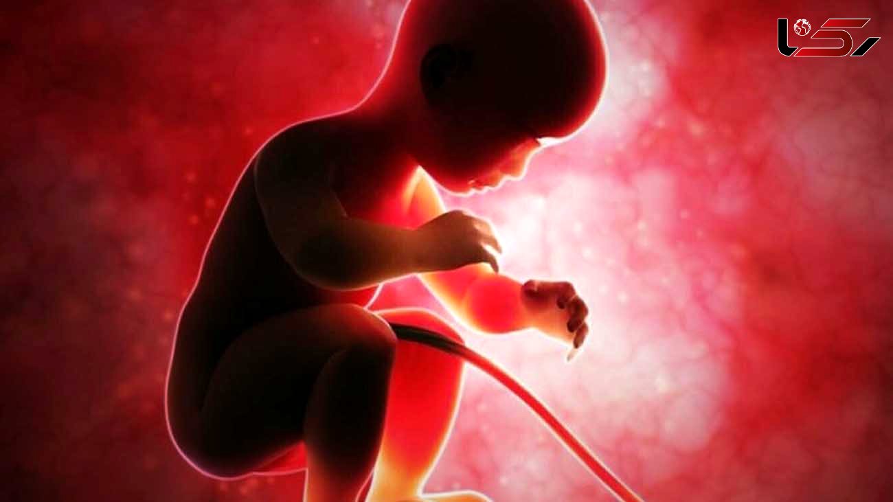 عوارض کشنده سقط عمدی جنین + اینفوگرافی