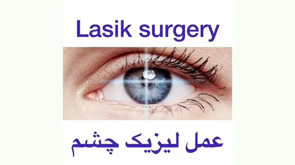 لیزیک چشم چطور انجام می شود؟ + فیلم