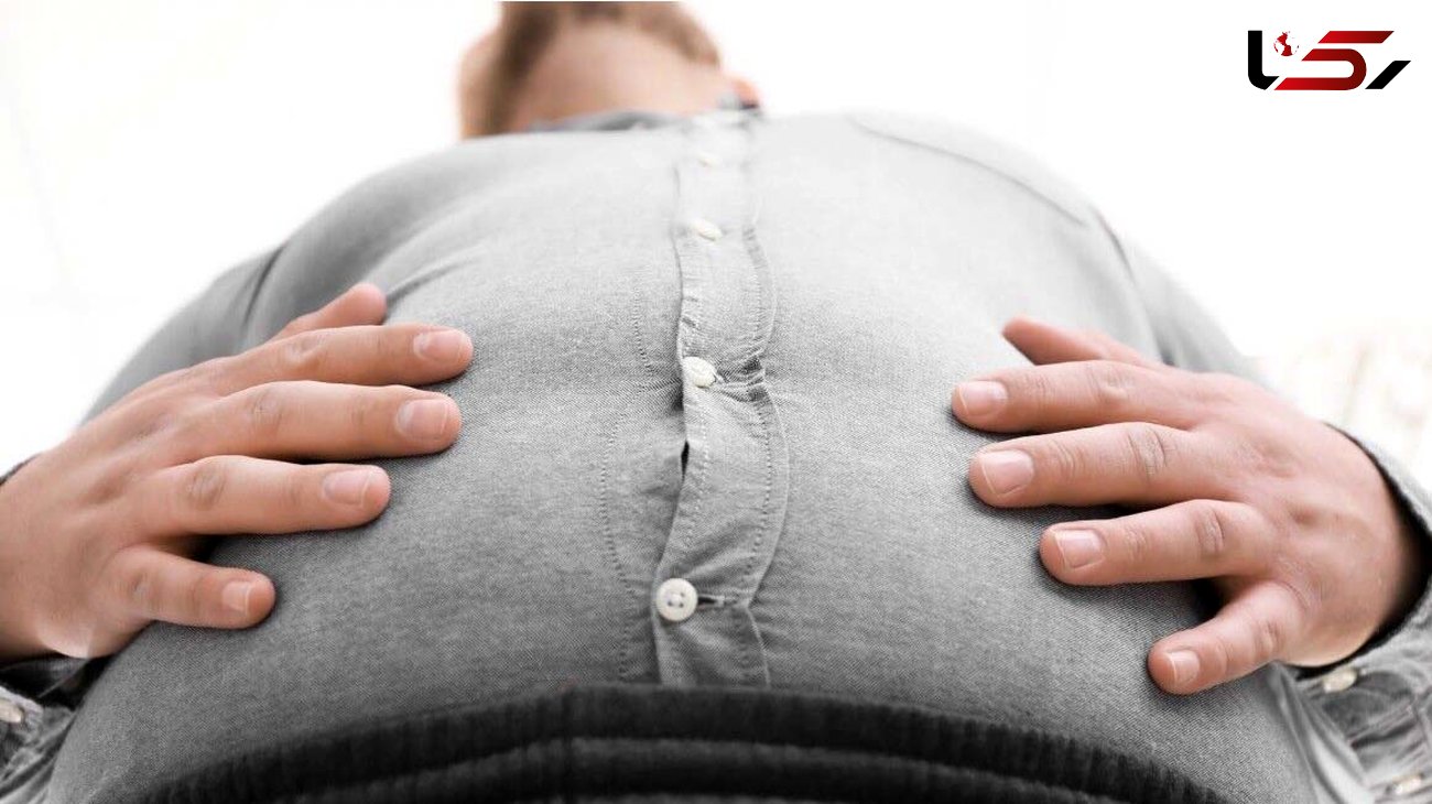  چاقی به طور مستقیم و غیرمستقیم در تشدید علائم کرونا تاثیر گذار است