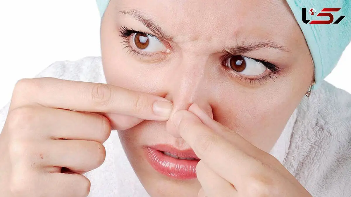 عامل به وجود آمدن جوش های زیر پوستی چیست؟