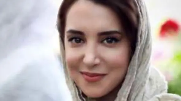 تغییر چهره سحر جعفری جوزانی با جراحی زیبایی / قرار بود عروسکی شود زشت شد! 