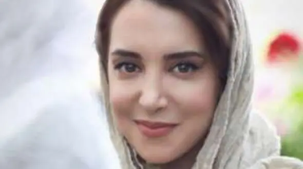 تغییر چهره سحر جعفری جوزانی با جراحی زیبایی / قرار بود عروسکی شود زشت شد! 
