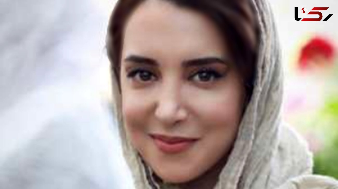 تغییر جنجالی چهره خانم بازیگر سریال‌های مهران مدیری ! / جادوی عمل زیبایی را ببینید