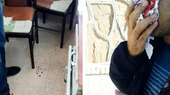 ضرب و شتم وحشیانه معلم یاسوجی توسط والدین دانش‌آموز + عکس