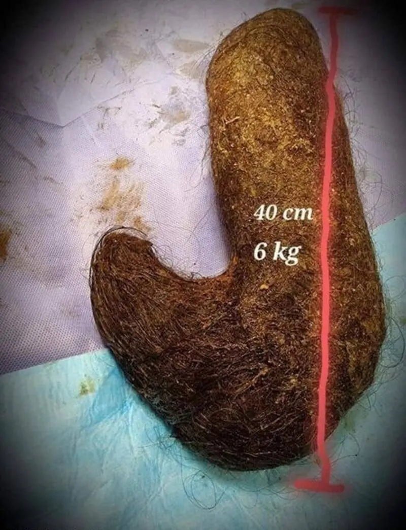 توده مو