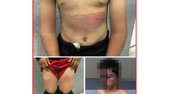 عکس های تکاندهنده از شکنجه پسر12 ساله در اتاق وحشت! / در مشهد فاش شد