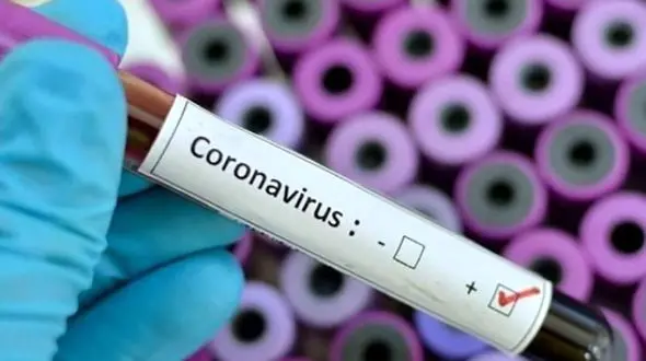 کرونا جان شجاع ترین پزشک انگلیس را گرفت / او حتی جلوی دولت ایستاد + عکس