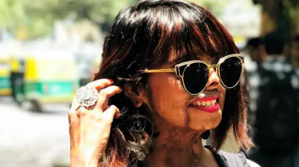 این دختر هنگامی که در آغوش مادرش شیر می خورد قربانی اسیدپاشی شد+ تصاویر
