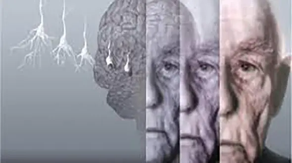 مقصر پیری مغز پیدا شد 