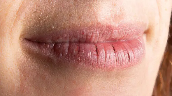 ماسک مخصوص لب های خشک 