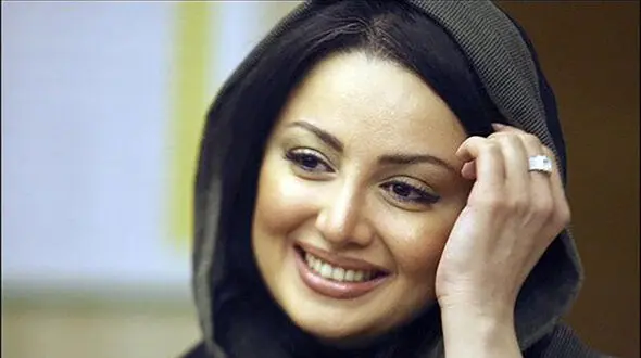 شیلا خداداد چه بود و چه شد؟ / تغییرات باورنکردنی با عمل های زیبایی!