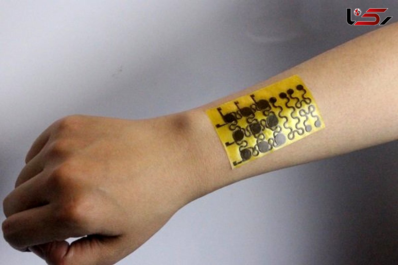 پوست الکترونیکی زخم های خود را ترمیم می کند