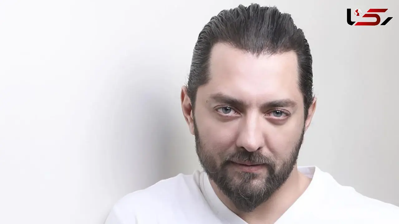 زیبایی بهرام رادان یک شبه نابود شد + عکس باورنکردنی