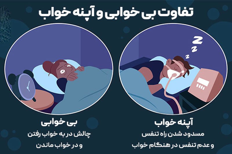 بی خوابی شب