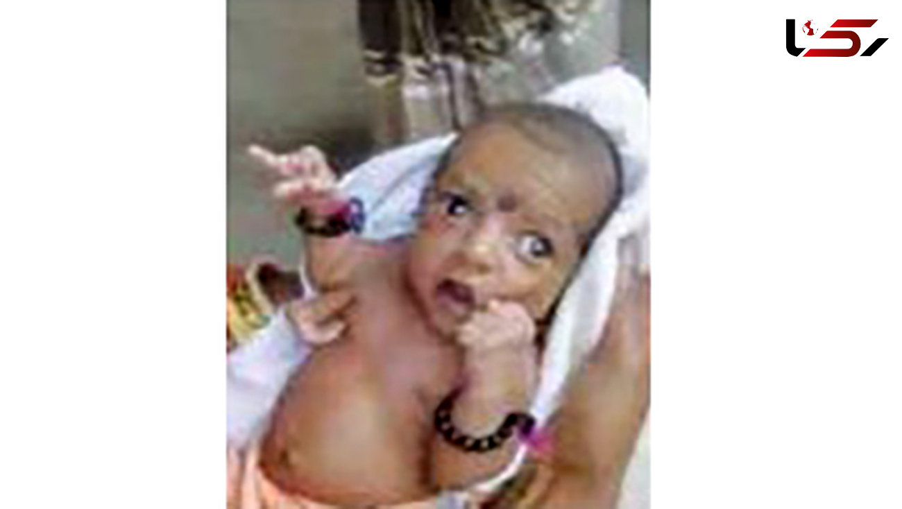 به دنیا آمدن نوزاد عجیبی که او را تبدیل به یک الهه کرد+ عکس