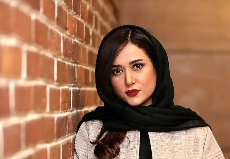 برای بازیگری صورت طبیعی خیلی مهم است