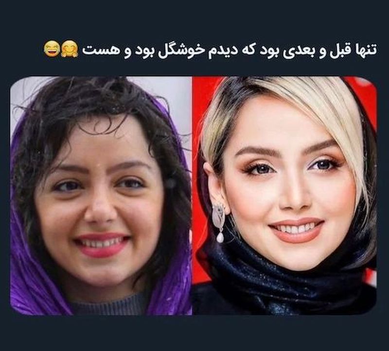 تغییر چهره نازنین بیاتی