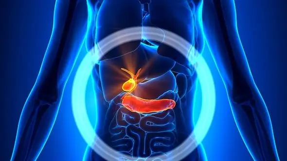 عوارض برداشتن کیسه صفرا چیست؟