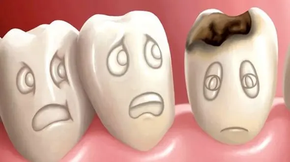 این خوراکی دندانهایتان را نابود می‌کنند